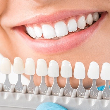 smile with cosmetic bonding