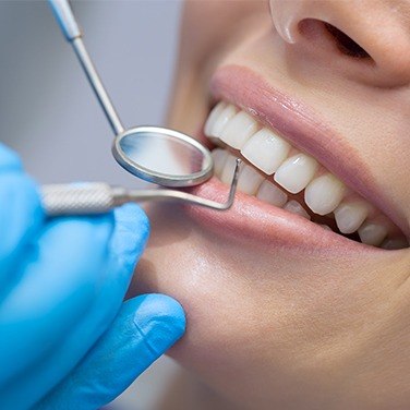 smile getting gum recontouring