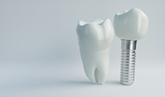 dental implant with crown next to natural tooth 