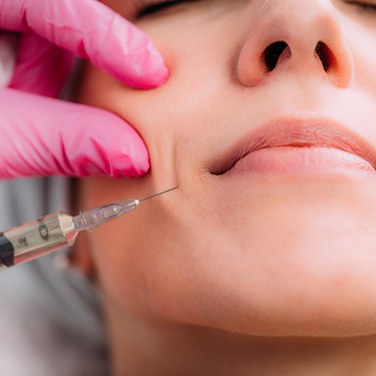  Patient receiving dermal fillers