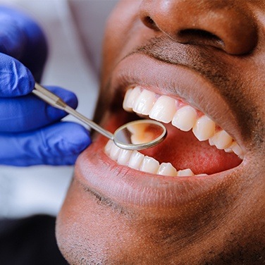 man having smile checked