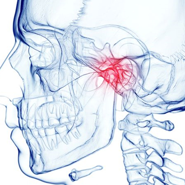 Illustration of human skull with TMJ highlighted in red